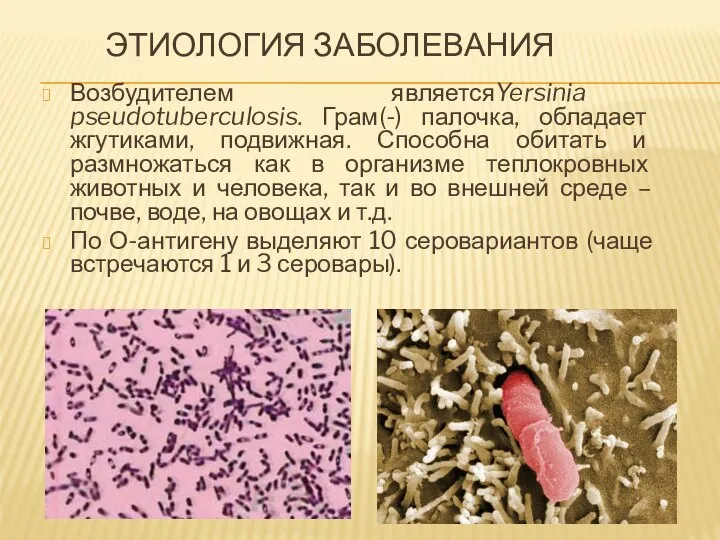 ЭТИОЛОГИЯ ЗАБОЛЕВАНИЯ Возбудителем являетсяYersinia pseudotuberculosis. Грам(-) палочка, обладает жгутиками, подвижная. Способна обитать