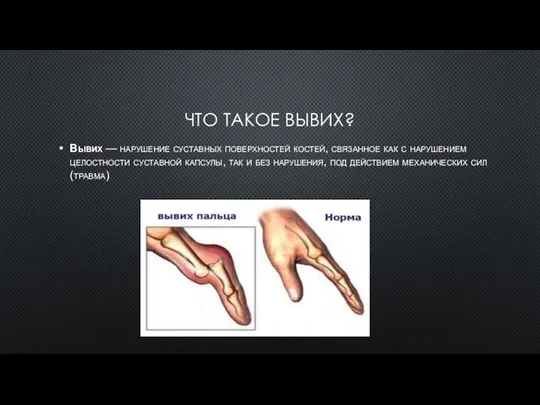 ЧТО ТАКОЕ ВЫВИХ? Вывих — нарушение суставных поверхностей костей, связанное как с
