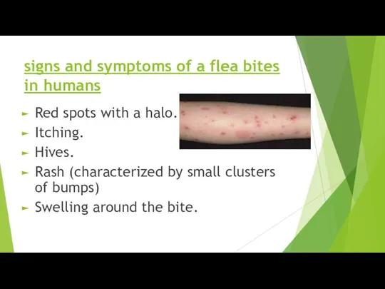 signs and symptoms of a flea bites in humans Red spots with