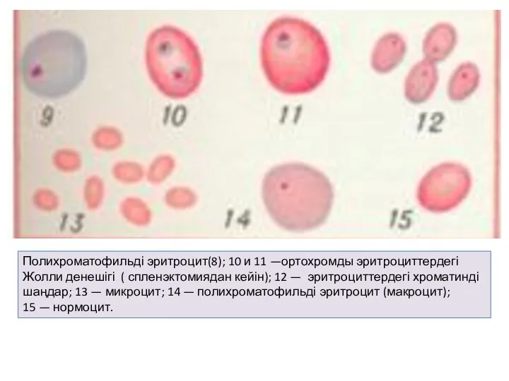 Полихроматофильді эритроцит(8); 10 и 11 —ортохромды эритроциттердегі Жолли денешігі ( спленэктомиядан кейін);