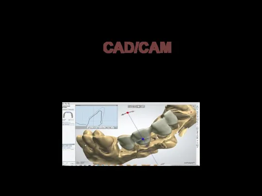это современная цифровая методика, которая автоматизирует процесс создания зубных протезов: заготовка моделируется