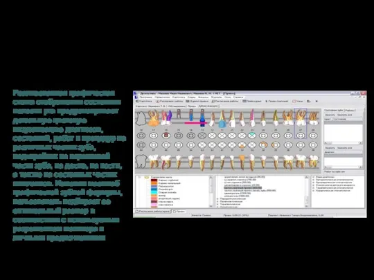 Денталика Реализованная графическая схема отображения состояния полости рта предусматривает детальную цветовую визуализацию
