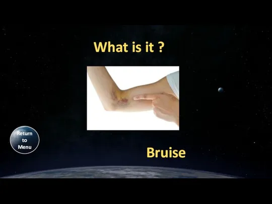 What is it ? Bruise Return to Menu