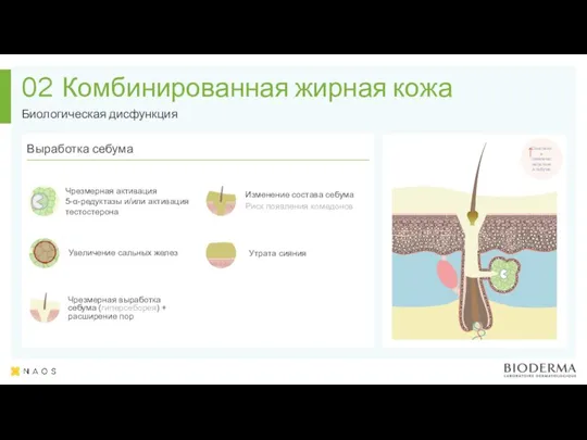 Чрезмерная выработка себума (гиперсеборея) + расширение пор Комбинированная жирная кожа Биологическая дисфункция