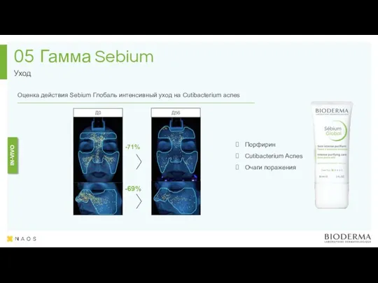 Гамма Sebium Уход 05 IN-VIVO Д0 Д56 -71% -69% Порфирин Cutibacterium Acnes Очаги поражения