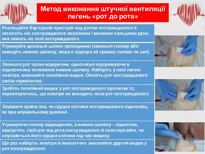 Метод виконання штучної вентиляції легень «рот до рота»