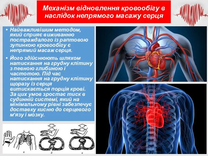 Механізм відновлення кровообігу в наслідок непрямого масажу серця Найважливішим методом, який сприяє