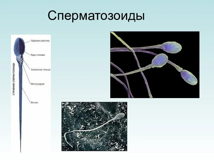 Сперматозоиды