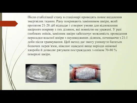 Після стабілізації стану в стаціонарі проводять повне видалення змертвілих тканин. Рану покривають