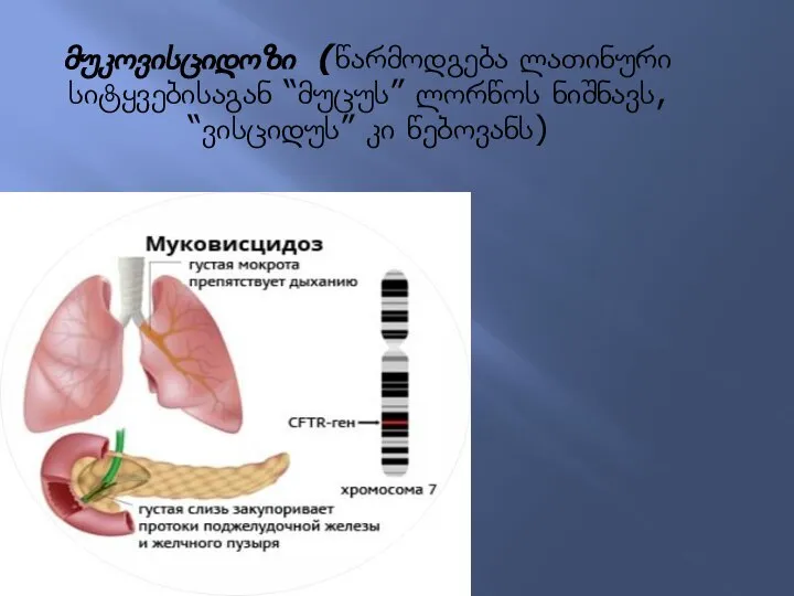 მუკოვისციდოზი (წარმოდგება ლათინური სიტყვებისაგან “მუცუს” ლორწოს ნიშნავს, “ვისციდუს” კი წებოვანს)