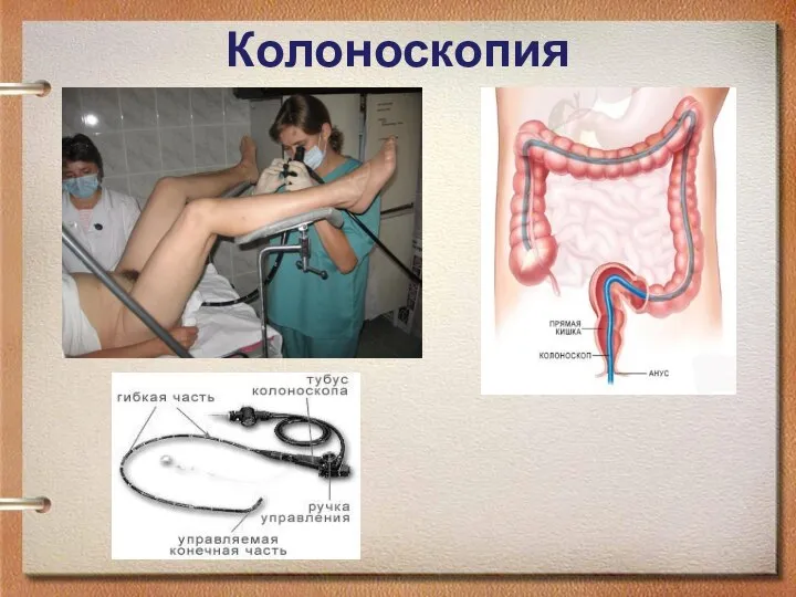 Колоноскопия