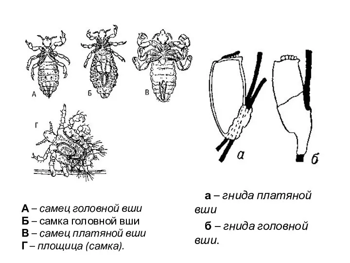 А – самец головной вши Б – самка головной вши В –