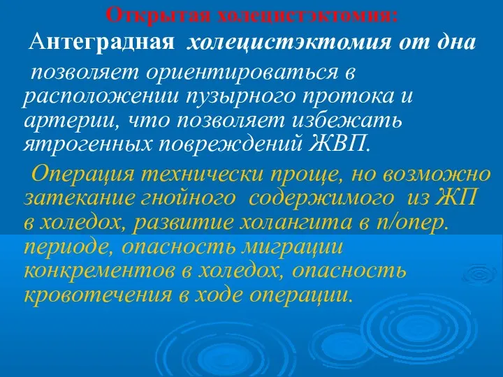 Открытая холецистэктомия: Антеградная холецистэктомия от дна позволяет ориентироваться в расположении пузырного протока