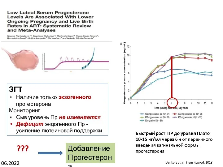 06.2022 ЗГТ Наличие только экзогенного прогестерона Мониторинг Сыв уровень Пр не изменяется