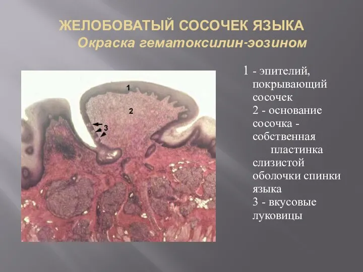 ЖЕЛОБОВАТЫЙ СОСОЧЕК ЯЗЫКА Окраска гематоксилин-эозином 1 - эпителий, покрывающий сосочек 2 -