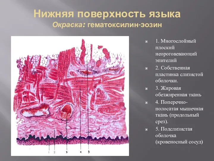 Нижняя поверхность языка Окраска: гематоксилин-эозин 1. Многослойный плоский неороговевающий эпителий 2. Собственная