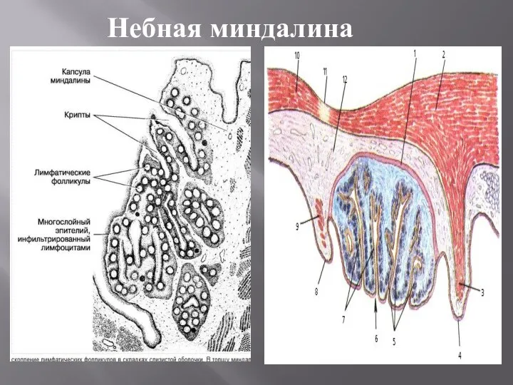 Небная миндалина