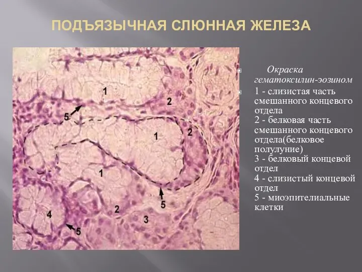 ПОДЪЯЗЫЧНАЯ СЛЮННАЯ ЖЕЛЕЗА Окраска гематоксилин-эозином 1 - слизистая часть смешанного концевого отдела