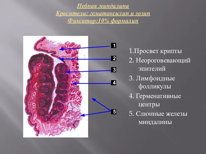 Небная миндалина Красители: гематоксилин и эозин Фиксатор:10% формалин 1.Просвет крипты 2. Неороговевающий