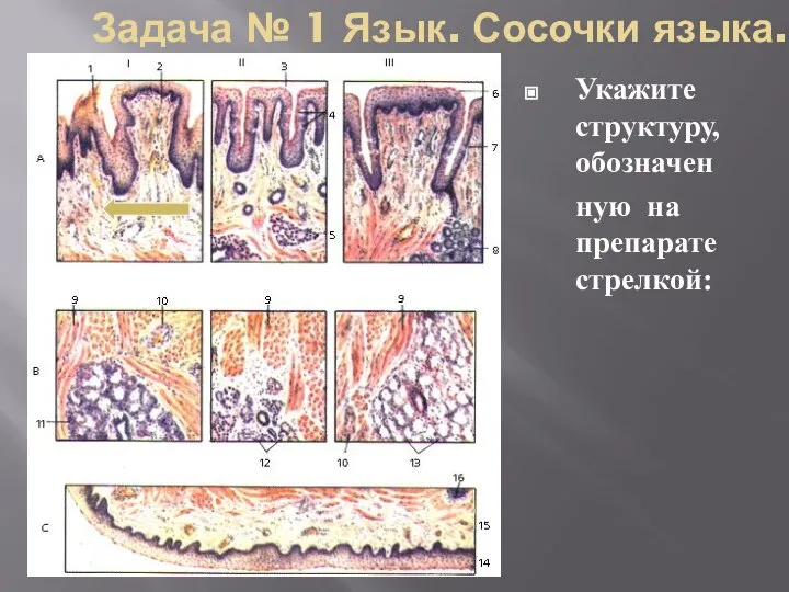 Задача № 1 Язык. Сосочки языка. Укажите структуру, обозначен ную на препарате стрелкой: