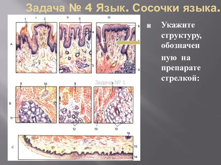 Задача № 4 Язык. Сосочки языка. Укажите структуру, обозначен ную на препарате стрелкой: Задача № 1