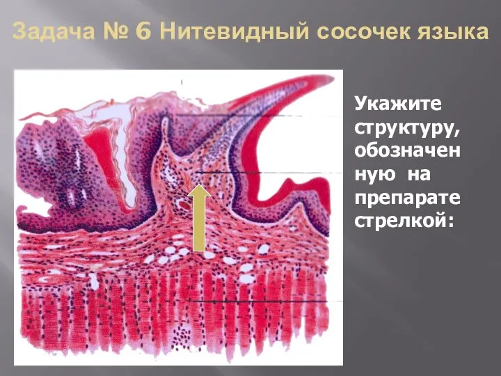 Задача № 6 Нитевидный сосочек языка Укажите структуру, обозначен ную на препарате стрелкой: