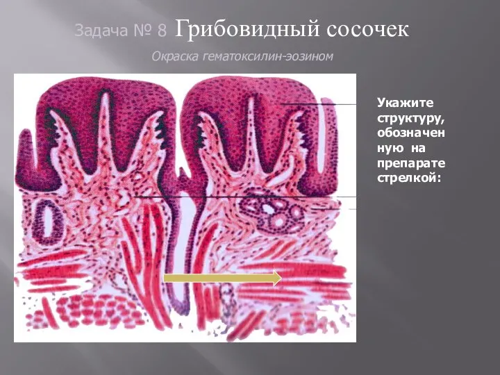 Задача № 8 Грибовидный сосочек Окраска гематоксилин-эозином Укажите структуру, обозначен ную на препарате стрелкой: