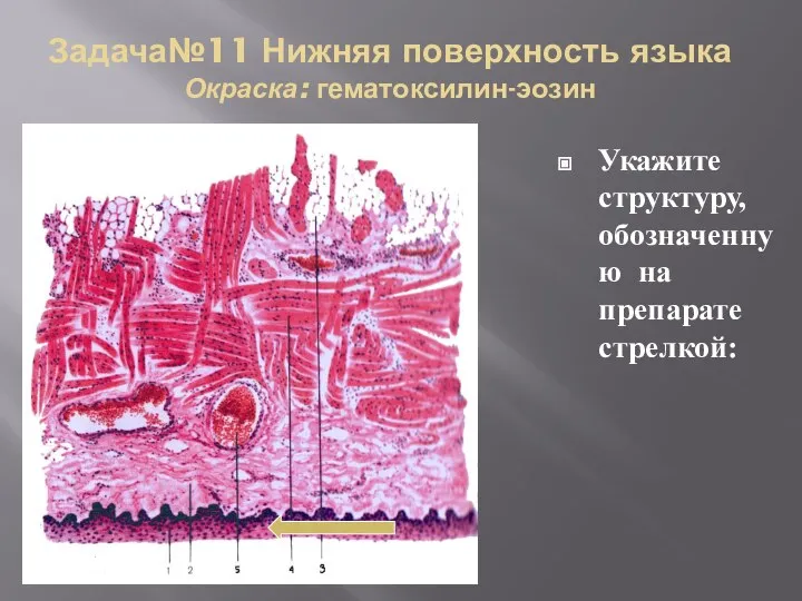 Задача№11 Нижняя поверхность языка Окраска: гематоксилин-эозин Укажите структуру, обозначенную на препарате стрелкой: