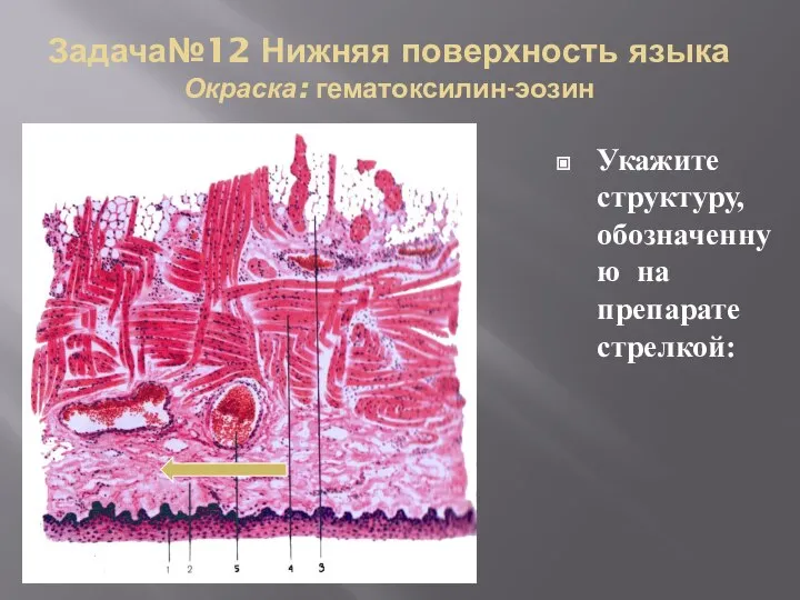 Задача№12 Нижняя поверхность языка Окраска: гематоксилин-эозин Укажите структуру, обозначенную на препарате стрелкой: