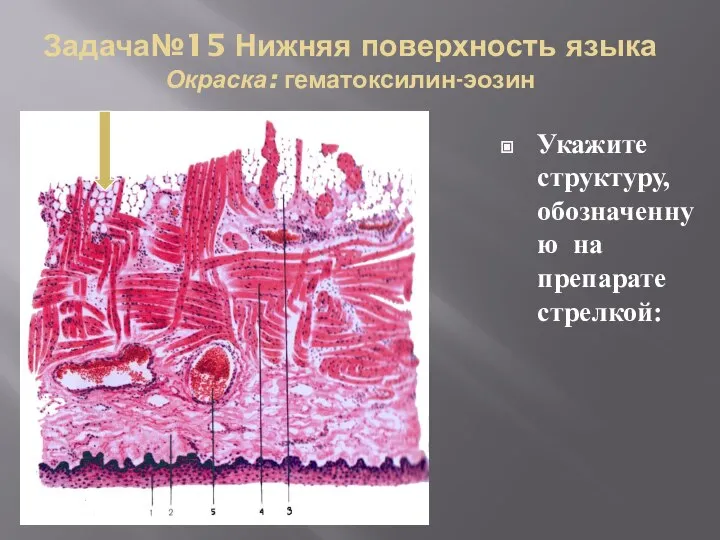 Задача№15 Нижняя поверхность языка Окраска: гематоксилин-эозин Укажите структуру, обозначенную на препарате стрелкой: