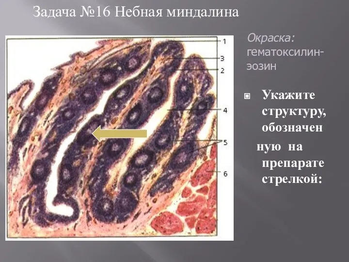 Задача №16 Небная миндалина Укажите структуру, обозначен ную на препарате стрелкой: Окраска: гематоксилин-эозин