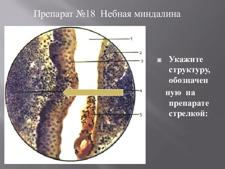 Укажите структуру, обозначен ную на препарате стрелкой: Препарат №18 Небная миндалина
