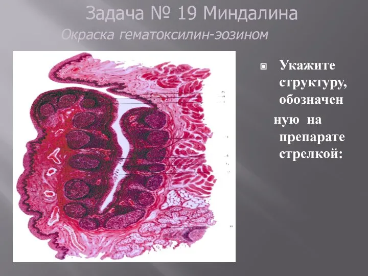 Укажите структуру, обозначен ную на препарате стрелкой: Задача № 19 Миндалина Окраска гематоксилин-эозином