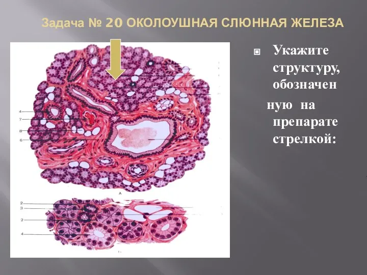 Задача № 20 ОКОЛОУШНАЯ СЛЮННАЯ ЖЕЛЕЗА Укажите структуру, обозначен ную на препарате стрелкой: