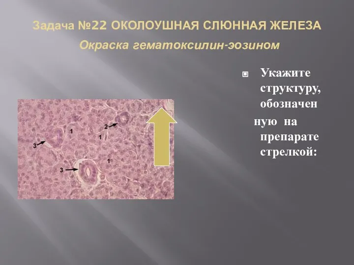 Задача №22 ОКОЛОУШНАЯ СЛЮННАЯ ЖЕЛЕЗА Окраска гематоксилин-эозином Укажите структуру, обозначен ную на препарате стрелкой: