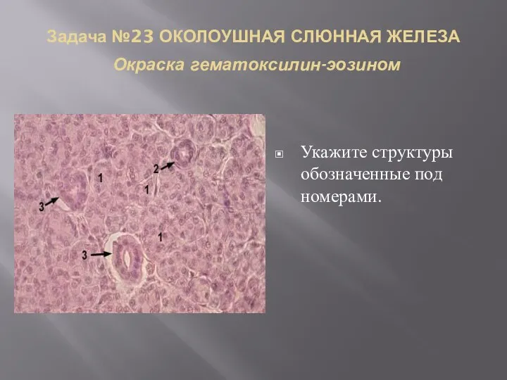 Задача №23 ОКОЛОУШНАЯ СЛЮННАЯ ЖЕЛЕЗА Окраска гематоксилин-эозином Укажите структуры обозначенные под номерами.