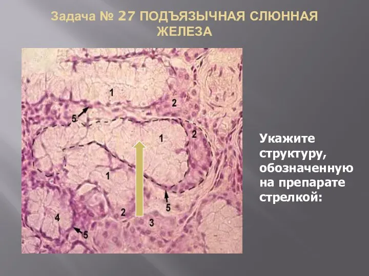 Задача № 27 ПОДЪЯЗЫЧНАЯ СЛЮННАЯ ЖЕЛЕЗА Укажите структуру, обозначенную на препарате стрелкой: