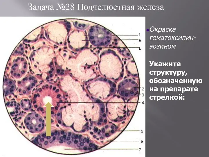 Задача №28 Подчелюстная железа Укажите структуру, обозначенную на препарате стрелкой: Окраска гематоксилин-эозином