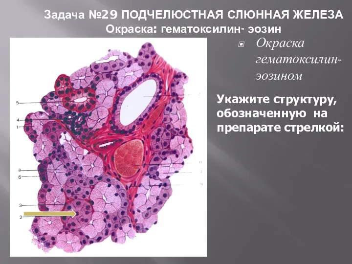 Окраска гематоксилин-эозином Задача №29 ПОДЧЕЛЮСТНАЯ СЛЮННАЯ ЖЕЛЕЗА Окраска: гематоксилин- эозин Укажите структуру, обозначенную на препарате стрелкой: