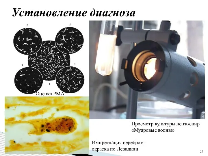 Установление диагноза Оценка РМА Просмотр культуры лептоспир «Муаровые волны» Импрегнация серебром – окраска по Левадиди