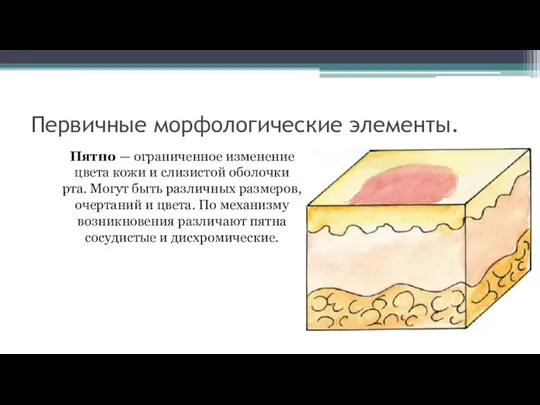 Первичные морфологические элементы. Пятно — ограниченное изменение цвета кожи и слизистой оболочки