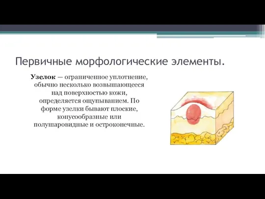 Первичные морфологические элементы. Узелок — ограниченное уплотнение, обычно несколько возвышающееся над поверхностью