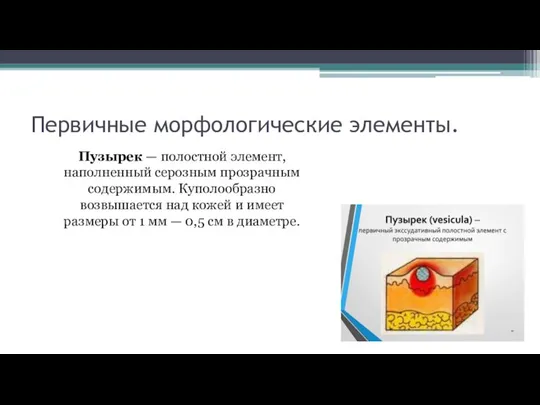 Первичные морфологические элементы. Пузырек — полостной элемент, наполненный серозным прозрачным содержимым. Куполообразно