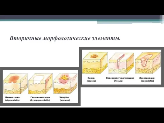 Вторичные морфологические элементы.