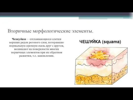 Вторичные морфологические элементы. Чешуйки — отслаивающиеся клетки верхних рядов рогового слоя, потерявшие