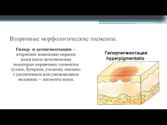 Вторичные морфологические элементы. Гипер- и депигментации — вторичное изменение окраски кожи после