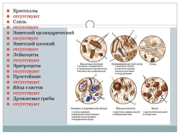 Кристаллы отсутствуют Слизь отсутствует Эпителий цилиндрический отсутствует Эпителий плоский отсутствует Лейкоциты отсутствуют