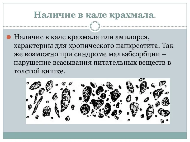 Наличие в кале крахмала. Наличие в кале крахмала или амилорея, характерны для