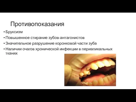 Противопоказания Бруксизм Повышенное стирание зубов-антагонистов Значительное разрушение коронковой части зуба Наличии очагов
