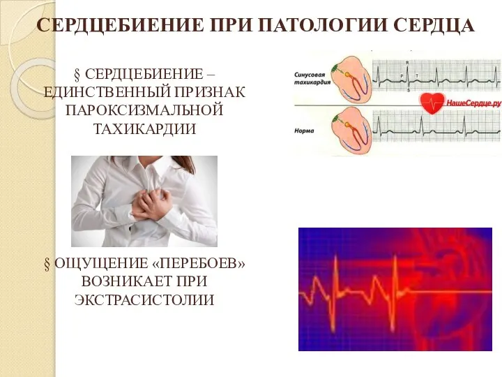 § СЕРДЦЕБИЕНИЕ – ЕДИНСТВЕННЫЙ ПРИЗНАК ПАРОКСИЗМАЛЬНОЙ ТАХИКАРДИИ § ОЩУЩЕНИЕ «ПЕРЕБОЕВ» ВОЗНИКАЕТ ПРИ